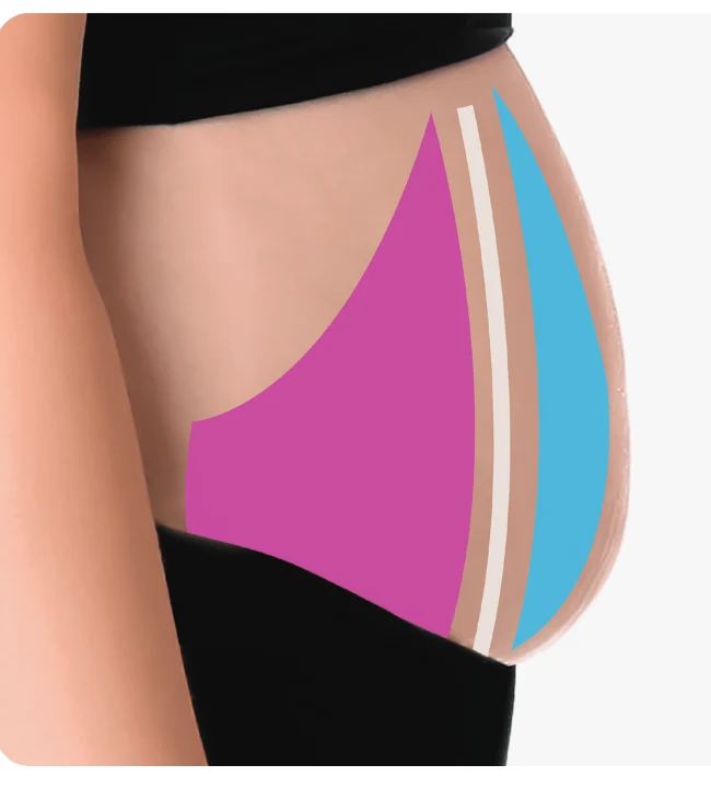 Coupe anatomique de l’abdomen : graisse sous-cutanée en surface, paroi abdominale, graisse viscérale autour des organes