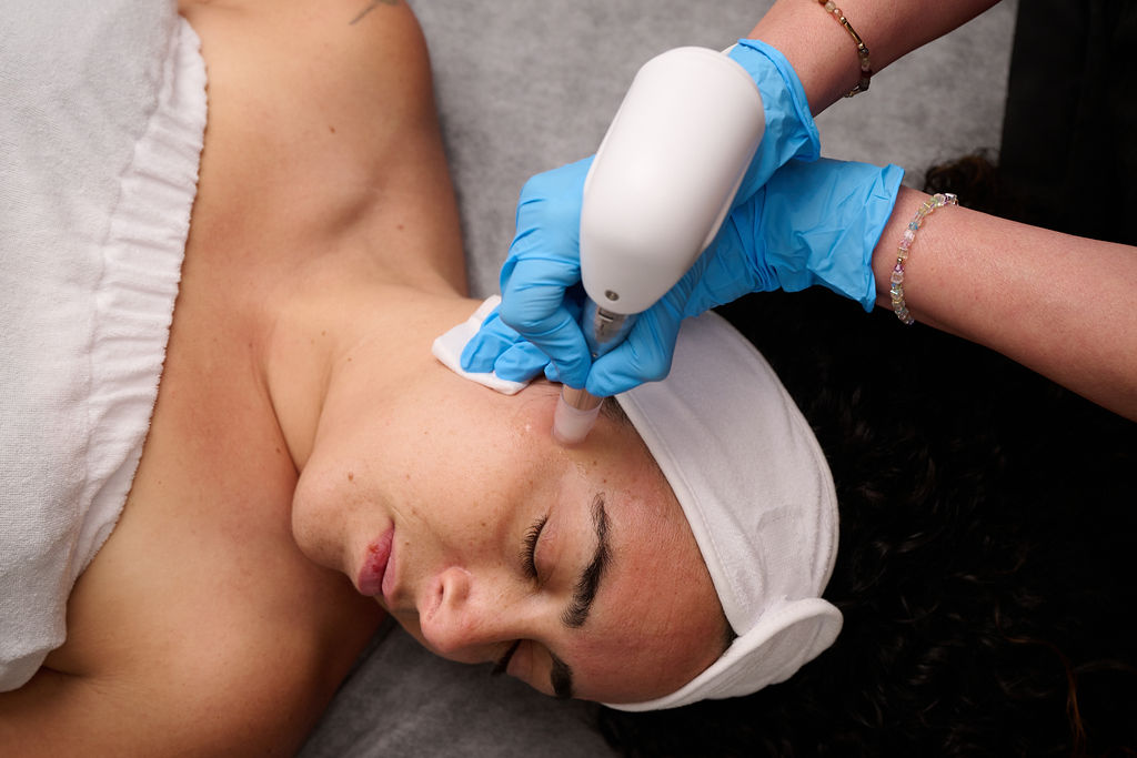 HydraFacial Syndeo — Console connectée en clinique O'Derma