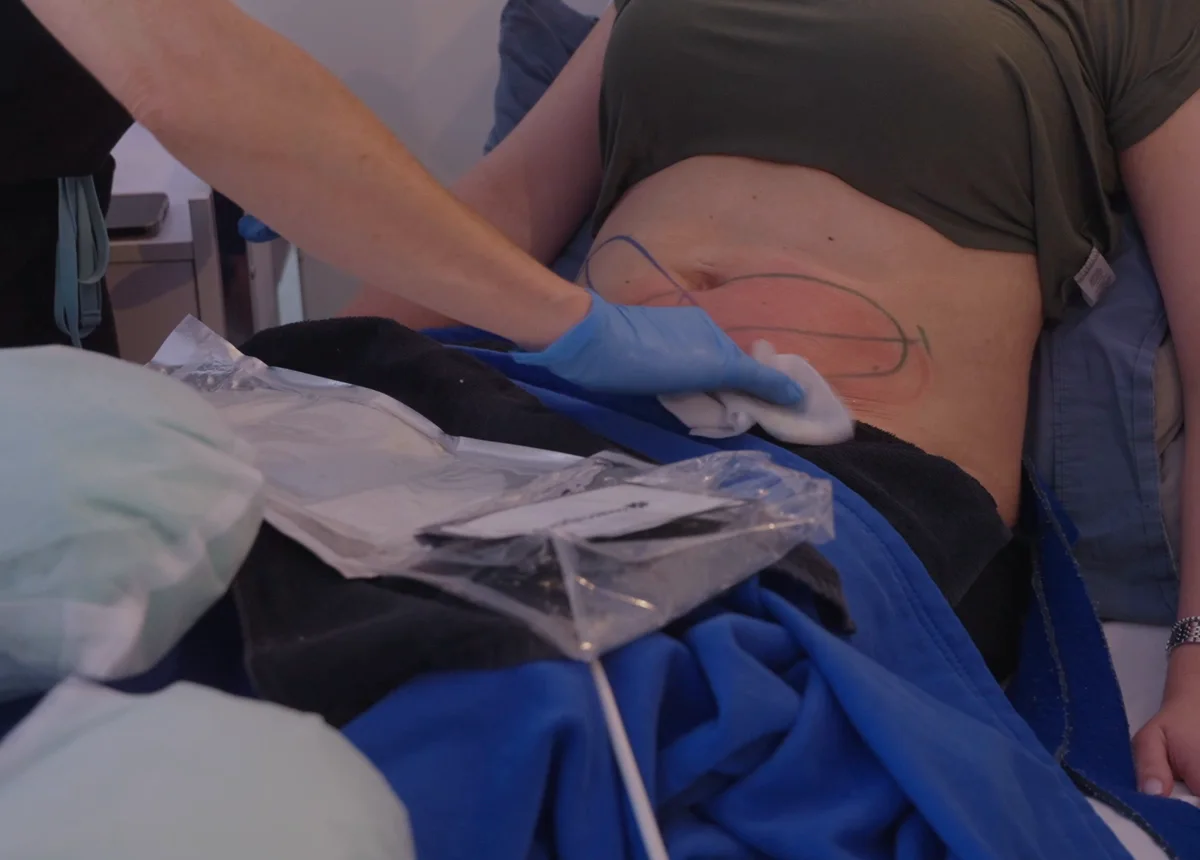 Graisse Abdominale