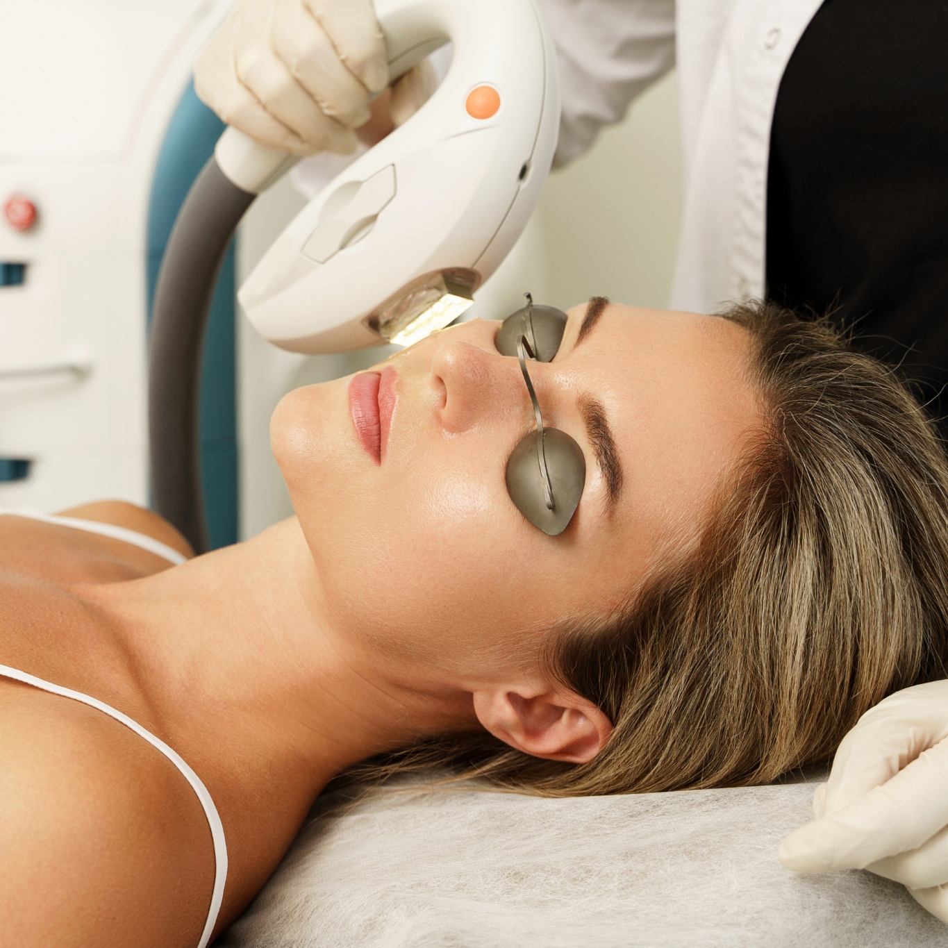 Séance de lumière pulsée intense (IPL) en clinique
