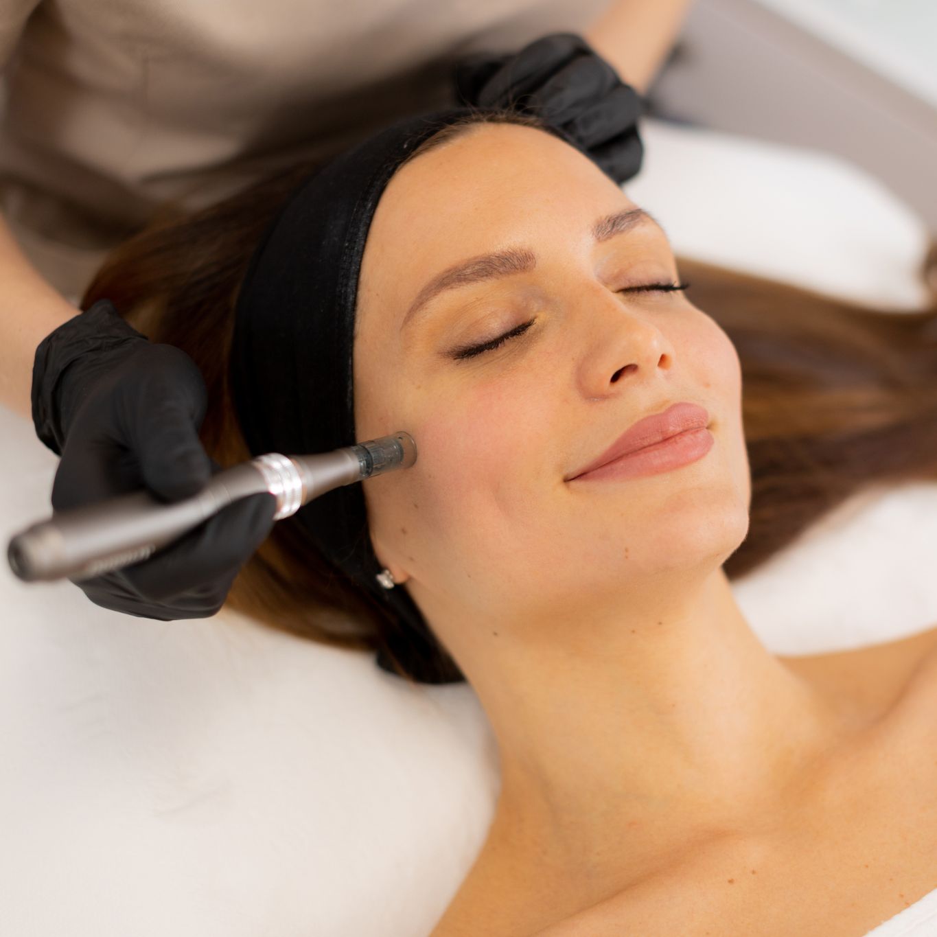 Système de microneedling médical — Console et pièce à main