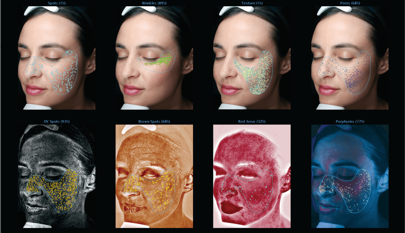 Système d'analyse de peau VISIA — vues multi-spectrales du visage
