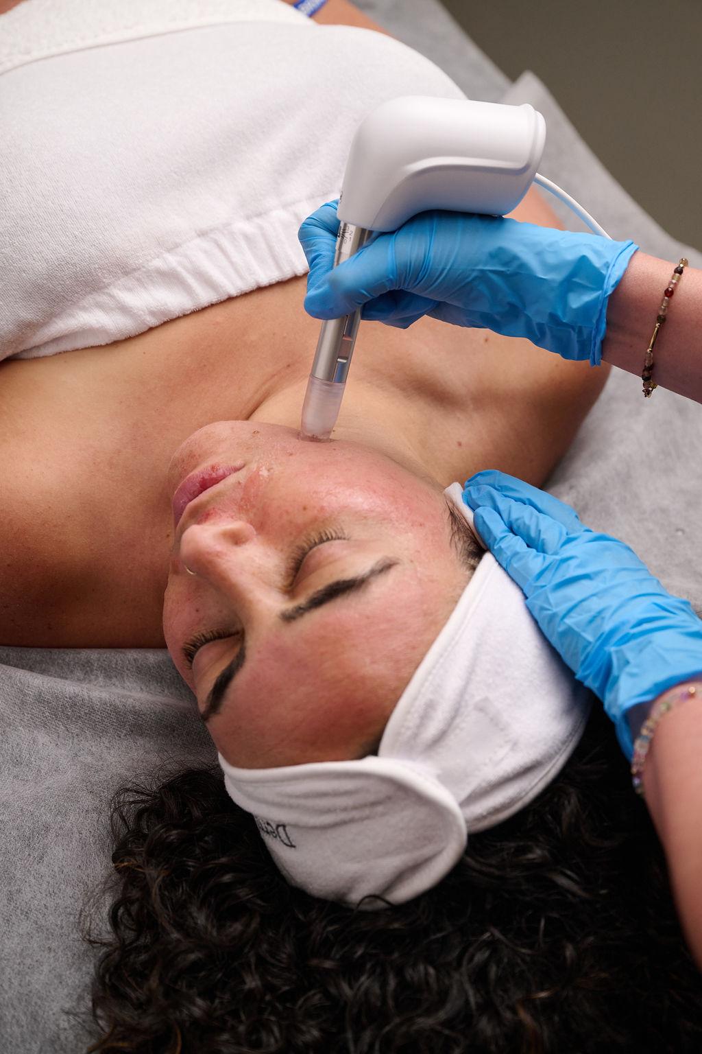 Épilation laser — Peau douce et libre, clinique O'Derma