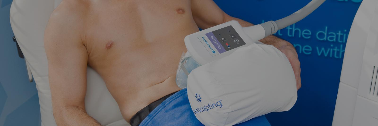 CoolSculpting vs liposuccion : comparatif honnête